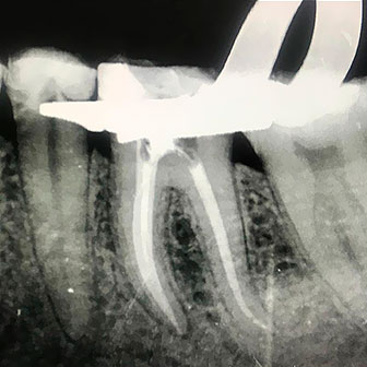 Dra-elina-gelves-radiografia1