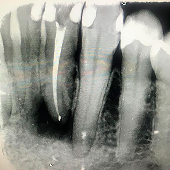 Dra-elina-gelves-radiografia3